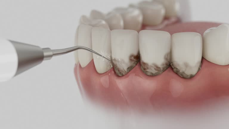 Trusted Wisdom Tooth Removal service in Tipton, CA - Dentist Open Now